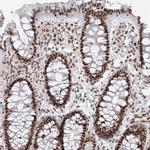 ZNF638 Antibody in Immunohistochemistry (Paraffin) (IHC (P))