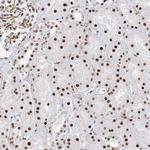 ZNF638 Antibody in Immunohistochemistry (Paraffin) (IHC (P))
