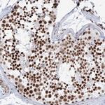ZNF638 Antibody in Immunohistochemistry (Paraffin) (IHC (P))