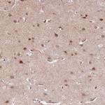 TCF20 Antibody in Immunohistochemistry (Paraffin) (IHC (P))
