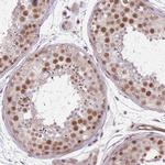 TCF20 Antibody in Immunohistochemistry (Paraffin) (IHC (P))