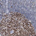 HAT1 Antibody in Immunohistochemistry (Paraffin) (IHC (P))