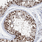 HAT1 Antibody in Immunohistochemistry (Paraffin) (IHC (P))