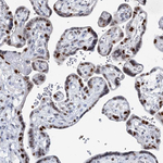 HAT1 Antibody in Immunohistochemistry (Paraffin) (IHC (P))