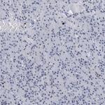 HAT1 Antibody in Immunohistochemistry (IHC)