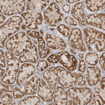 SH3BP2 Antibody in Immunohistochemistry (Paraffin) (IHC (P))