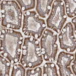 SH3BP2 Antibody in Immunohistochemistry (Paraffin) (IHC (P))