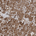 SH3BP2 Antibody in Immunohistochemistry (Paraffin) (IHC (P))