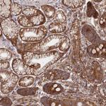PPP1R21 Antibody in Immunohistochemistry (Paraffin) (IHC (P))
