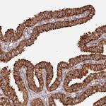 PPP1R21 Antibody in Immunohistochemistry (Paraffin) (IHC (P))