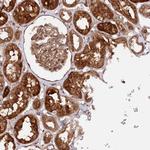PPP1R21 Antibody in Immunohistochemistry (Paraffin) (IHC (P))