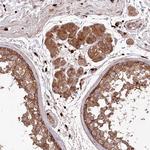 PPP1R21 Antibody in Immunohistochemistry (Paraffin) (IHC (P))