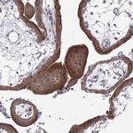 GPN1 Antibody in Immunohistochemistry (Paraffin) (IHC (P))