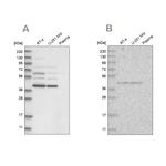 GPN1 Antibody in Western Blot (WB)