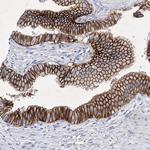 GPN1 Antibody in Immunohistochemistry (Paraffin) (IHC (P))