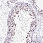 TEX15 Polyclonal Antibody