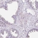 TEX15 Antibody in Immunohistochemistry (IHC)