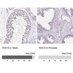 TEX15 Antibody