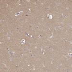 MED12L Antibody in Immunohistochemistry (IHC)