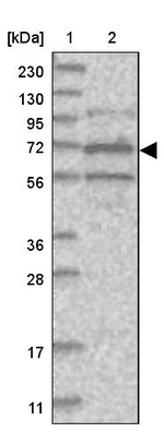 SOWAHB Antibody in Western Blot (WB)