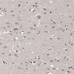 SOWAHB Antibody in Immunohistochemistry (Paraffin) (IHC (P))