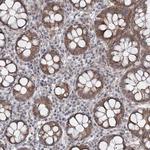 SOWAHB Antibody in Immunohistochemistry (Paraffin) (IHC (P))