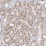 SOWAHB Antibody in Immunohistochemistry (Paraffin) (IHC (P))