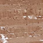 DNAJC27 Antibody in Immunohistochemistry (Paraffin) (IHC (P))