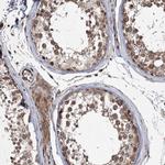 DNAJC27 Antibody in Immunohistochemistry (IHC)