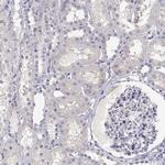 CDHR1 Antibody in Immunohistochemistry (Paraffin) (IHC (P))
