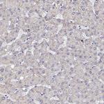 CDHR1 Antibody in Immunohistochemistry (Paraffin) (IHC (P))