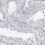 CDHR1 Antibody in Immunohistochemistry (Paraffin) (IHC (P))