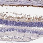 CDHR1 Antibody in Immunohistochemistry (IHC)