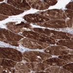 TATD2 Antibody in Immunohistochemistry (Paraffin) (IHC (P))