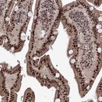 TATD2 Antibody in Immunohistochemistry (Paraffin) (IHC (P))