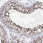 TATD2 Antibody in Immunohistochemistry (Paraffin) (IHC (P))