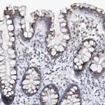 VWA5B2 Antibody in Immunohistochemistry (Paraffin) (IHC (P))