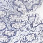 VWA5B2 Antibody in Immunohistochemistry (IHC)