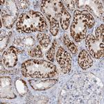 NGLY1 Antibody in Immunohistochemistry (IHC)