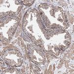 NGLY1 Antibody in Immunohistochemistry (IHC)