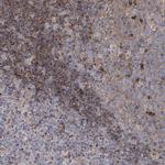 NGLY1 Antibody in Immunohistochemistry (IHC)