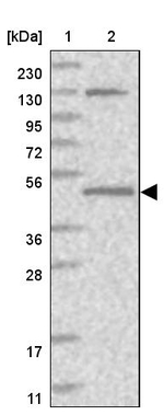 QTRTD1 Antibody in Western Blot (WB)