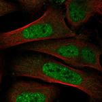 TRIP12 Polyclonal Antibody