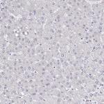 TRIP12 Antibody in Immunohistochemistry (Paraffin) (IHC (P))