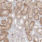 STK11IP Antibody in Immunohistochemistry (Paraffin) (IHC (P))