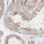 STK11IP Antibody in Immunohistochemistry (Paraffin) (IHC (P))
