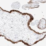 STK11IP Polyclonal Antibody