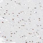 PRMT9 Antibody in Immunohistochemistry (Paraffin) (IHC (P))