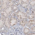 PRMT9 Antibody in Immunohistochemistry (Paraffin) (IHC (P))