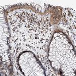 PRMT9 Antibody in Immunohistochemistry (Paraffin) (IHC (P))